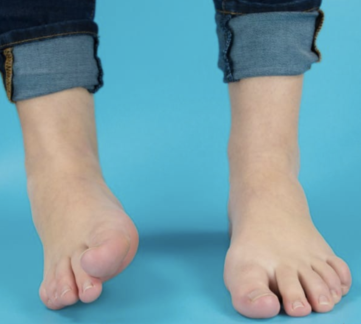 Exercises And Stretches To Improve Ankle Mobility