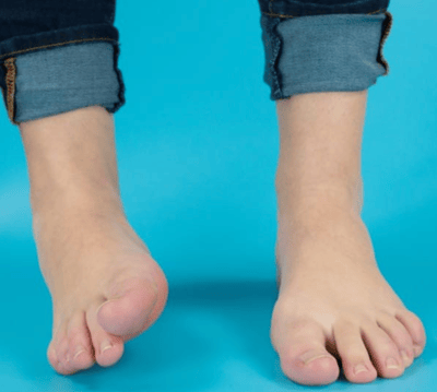 chiropractor for ankle pain