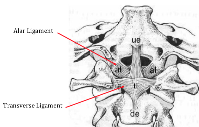 Diagnosing a Whiplash Injury with MRI