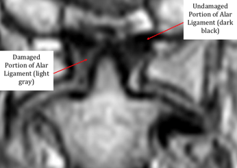 MRI's and Soft Tissue Injuries