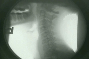Neck X ray