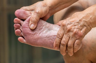 Florida Senior seeks Neuropathy Treatment for foot pain