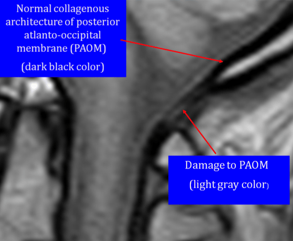 New MRI Technology