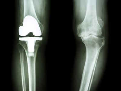 Lakeland Knee Pain Treatment Pain Relief Ethos Health Group