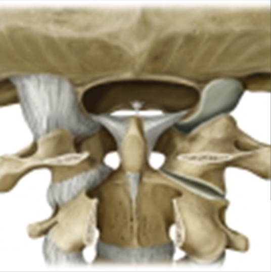 Severe Spinal Injuries